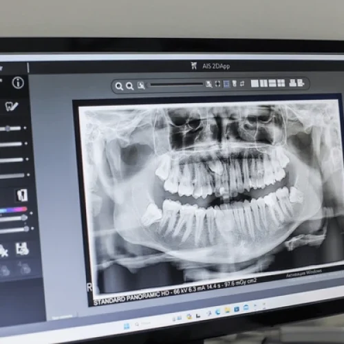 dental panaromic